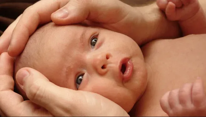 Torcicollo miogeno nei neonati